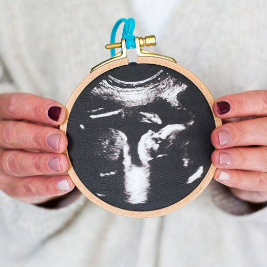 Baby Scan Photo Embroidery Hoop